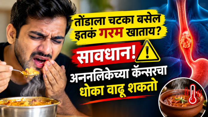 Hot Food and Esophageal Cancer Risk – Health Warning